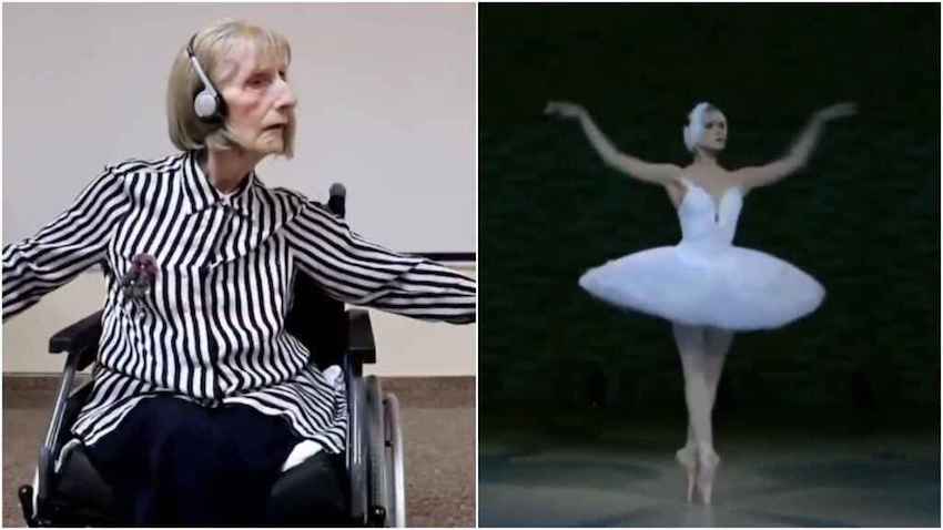 alzheimer ballet